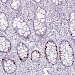 ATAD2 Antibody (CL0182), Novus Biologicals:Antibodies:Primary Antibodies