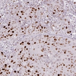 ATAD2 Antibody (CL0182), Novus Biologicals:Antibodies:Primary Antibodies
