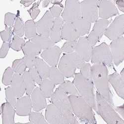 ATAD2 Antibody (CL0182), Novus Biologicals:Antibodies:Primary Antibodies