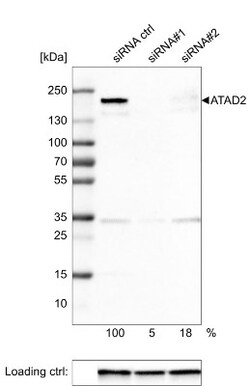 ATAD2 Antibody (CL0182), Novus Biologicals:Antibodies:Primary Antibodies