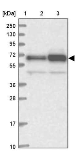 ATE1 Antibody, Novus Biologicals 0.1mL; Unlabeled:Antibodies, Polyclonal