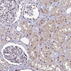 ATF1 Antibody, Novus Biologicals 0.1mL; Unlabeled:Antibodies, Polyclonal