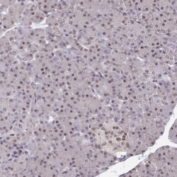 ATF1 Antibody, Novus Biologicals 0.1mL; Unlabeled:Antibodies, Polyclonal