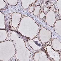 ATF1 Antibody, Novus Biologicals 0.1mL; Unlabeled:Antibodies, Polyclonal