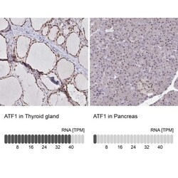 ATF1 Antibody, Novus Biologicals 0.1mL; Unlabeled:Antibodies, Polyclonal