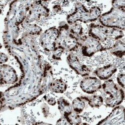 ATF3 Antibody (CL1685), Novus Biologicals:Antibodies:Primary Antibodies