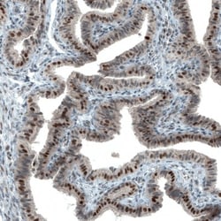 ATF3 Antibody (CL1685), Novus Biologicals:Antibodies:Primary Antibodies