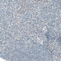 ATF3 Antibody (CL1685), Novus Biologicals:Antibodies:Primary Antibodies