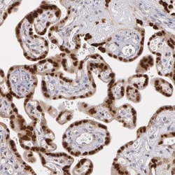 ATF3 Antibody, Novus Biologicals 25 &mu;L, Unconjugated:Antibodies, Polyclonal