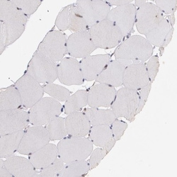 ATF3 Antibody, Novus Biologicals 25 &mu;L, Unconjugated:Antibodies, Polyclonal