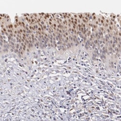 ATF3 Antibody, Novus Biologicals 25 &mu;L, Unconjugated:Antibodies, Polyclonal
