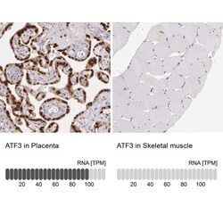 ATF3 Antibody, Novus Biologicals 25 &mu;L, Unconjugated:Antibodies, Polyclonal