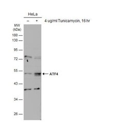 ATF4 Antibody, Novus Biologicals 0.1mL; Unlabeled:Antibodies, Polyclonal