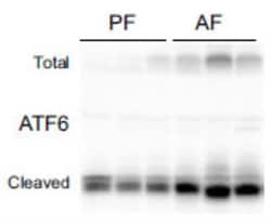 ATF6 Antibody (70B1413.1) - BSA Free, Novus Biologicals 0.1mg; Unlabeled:Antibodies,