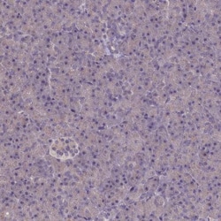 ATF7IP2 Antibody, Novus Biologicals 25 &mu;L, Unlabeled:Antibodies, Polyclonal