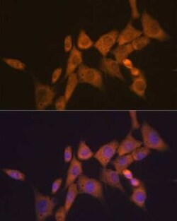 ATG10 Rabbit anti-Human, Mouse, Clone: 2Q3Q3, Novus Biologicals:Antibodies:Primary