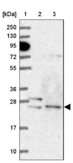 ATG101 Antibody, Novus Biologicals 25 &mu;L | Buy Online | Novus Biologicals | Fisher Scientific
