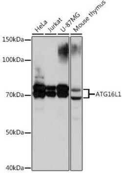ATG16L1 Rabbit anti-Human, Mouse, Clone: 5N2N9, Novus Biologicals 100 &mu;g | Buy Online | Bio-Techne | Fisher Scientific