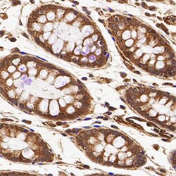 ATG16L1 Antibody - BSA Free, Novus Biologicals 0.1mL; Unlabeled:Antibodies,