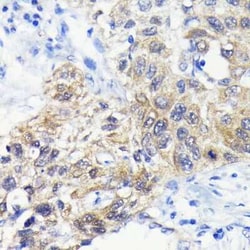 ATG3/APG3 Rabbit anti-Human, Mouse, Rat, Clone: 5D2W0, Novus Biologicals:Antibodies:Primary