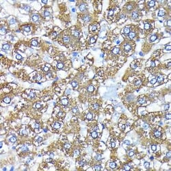 ATG3/APG3 Rabbit anti-Human, Mouse, Rat, Clone: 5D2W0, Novus Biologicals:Antibodies:Primary