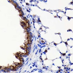ATG3/APG3 Rabbit anti-Human, Mouse, Rat, Clone: 5D2W0, Novus Biologicals:Antibodies:Primary