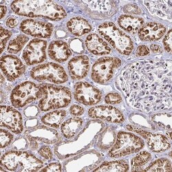 ATG3/APG3 Antibody, Novus Biologicals 25 &mu;L, Unlabeled:Antibodies, Polyclonal