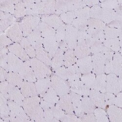 ATG3/APG3 Antibody, Novus Biologicals 25 &mu;L, Unlabeled:Antibodies, Polyclonal