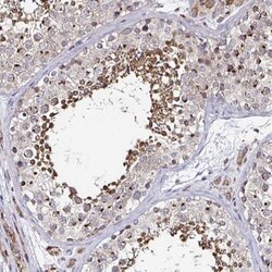 ATG3/APG3 Antibody, Novus Biologicals 25 &mu;L, Unlabeled:Antibodies, Polyclonal