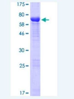 Novus Biologicals Recombinant Human ATG4A GST (N-Term) Protein 25 &mu;g | Buy Online | Novus Biologicals&trade; | Fisher Scientific