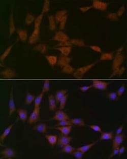 ATG4B Rabbit anti-Human, Mouse, Rat, Clone: 9H6M6, Novus Biologicals 100