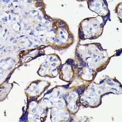 ATG5 Rabbit anti-Human, Mouse, Rat, Clone: 8L7X6, Novus Biologicals 100