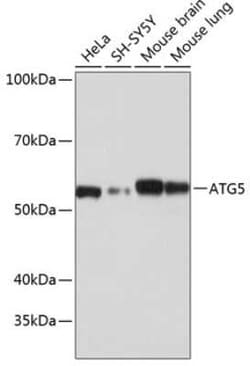 ATG5 Rabbit anti-Human, Mouse, Rat, Clone: 8L7X6, Novus Biologicals 100