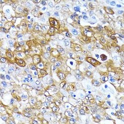 ATG7 Rabbit anti-Human, Mouse, Rat, Clone: 3X1W4, Novus Biologicals:Antibodies:Primary