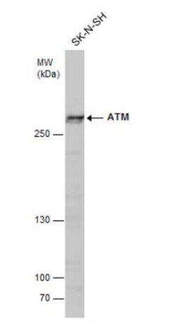 ATM Antibody (2C1), Novus Biologicals 0.1mg; Unlabeled:Antibodies, Monoclonal