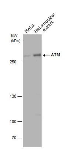 ATM Antibody (2C1), Novus Biologicals 0.1mg; Unlabeled:Antibodies, Monoclonal