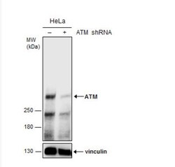 ATM Antibody (2C1), Novus Biologicals 0.1mg; Unlabeled:Antibodies, Monoclonal