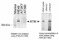 ATM Antibody (2C1), Novus Biologicals 0.1mg; Unlabeled:Antibodies, Monoclonal