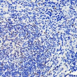 ATM Rabbit anti-Human, Mouse, Rat, Clone: 6P6C6, Novus Biologicals:Antibodies:Primary