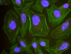 ATM Antibody, Novus Biologicals 0.1mg; Unlabeled:Antibodies, Polyclonal