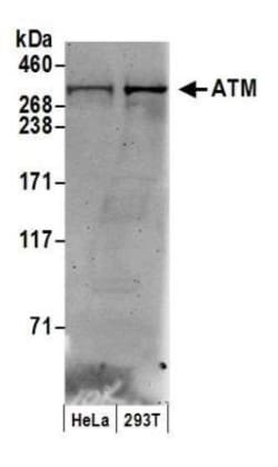 ATM Antibody, Novus Biologicals 0.1mg; Unlabeled:Antibodies, Polyclonal