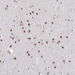 ATN1 Antibody, Novus Biologicals 25 &mu;L; Unlabeled:Antibodies, Polyclonal