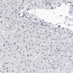 ATN1 Antibody, Novus Biologicals 25 &mu;L; Unlabeled:Antibodies, Polyclonal