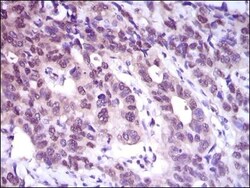 ATP Citrate Lyase Antibody (5F8D11) - BSA Free, Novus Biologicals 0.1mL;