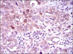 ATP Citrate Lyase Antibody (5F8D11) - BSA Free, Novus Biologicals 0.1mL;
