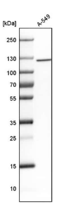 ATP Citrate Lyase Antibody, Novus Biologicals 0.1mL; Unlabeled:Anticuerpos