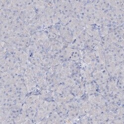 ATP4A Antibody, Novus Biologicals 0.1 mL | Buy Online | Novus Biologicals | Fisher Scientific