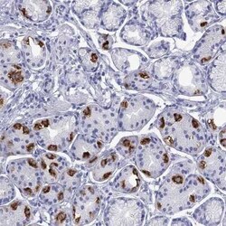 ATP4A Rabbit anti-Human, Polyclonal, Novus Biologicals 25 &mu;g; Unconjugated:Antibodies,