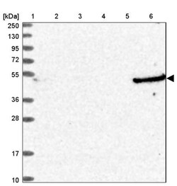 ATP5A Antibody, Novus Biologicals 0.1mL; Unlabeled:Antibodies, Polyclonal