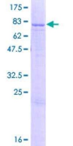 Novus Biologicals Recombinant Human ATP5A GST (N-Term) Protein 2 &mu;g | Buy Online | Novus Biologicals&trade; | Fisher Scientific